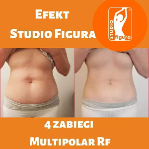 Efekty multipolar RF